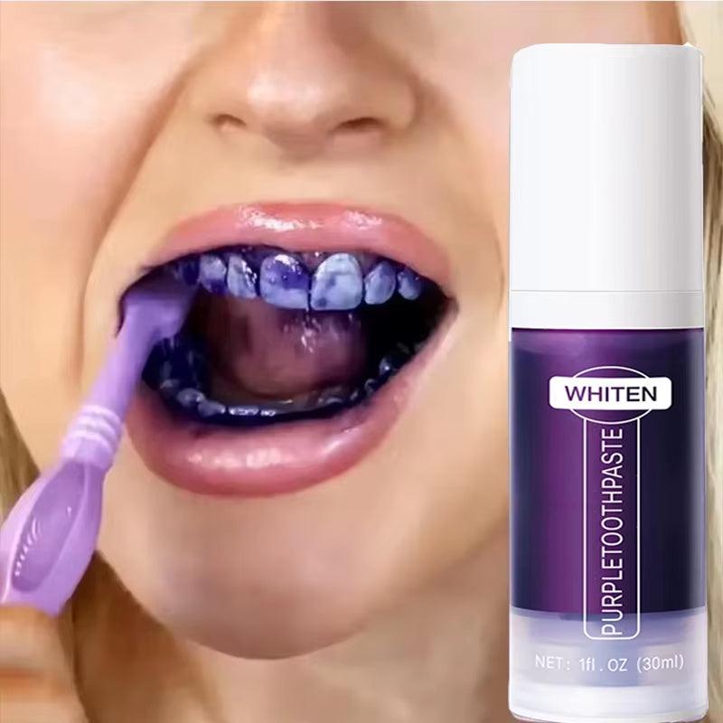 V34 5D Teeth Whitening Toothpaste – Ultimate Oral Care for a Bright, Fresh Smile! - Bodo Now